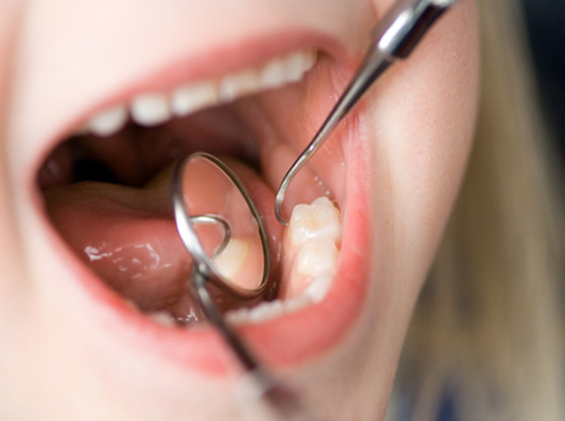 A girl’s teeth being examined by a dentist