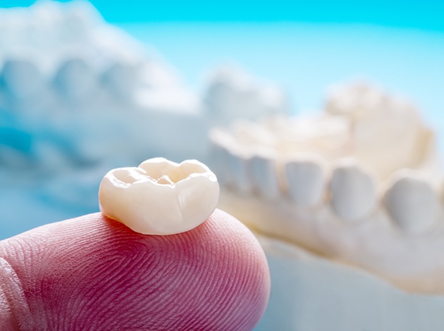 Dental crown resting on person’s fingertip