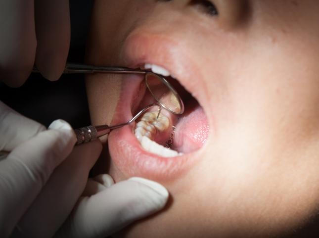 Close up of dentist giving a child a dental exam