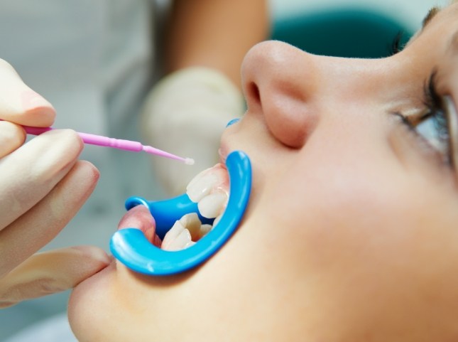 Child having fluoride applied to their teeth