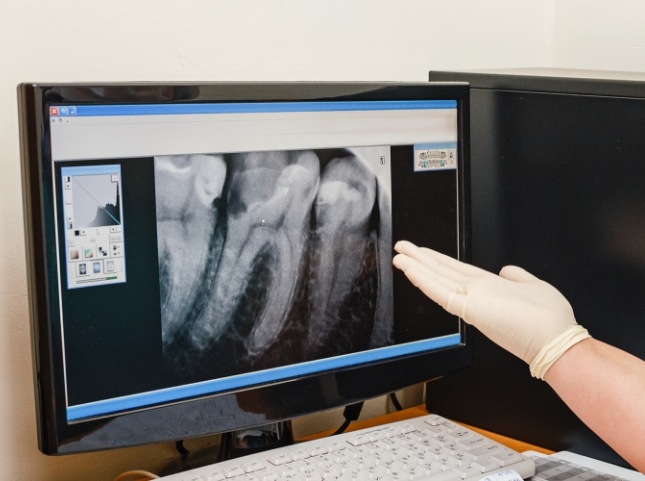 Glvoed hand gesturing to computer screen showing x rays of teeth
