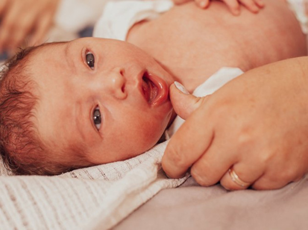 Baby with tongue tie